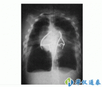 美國(guó)CIRS 602三維軀干模體
