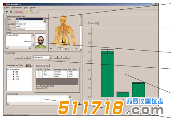 德國PTW In-vivo Dosimetry劑量計系統(tǒng)軟件.png